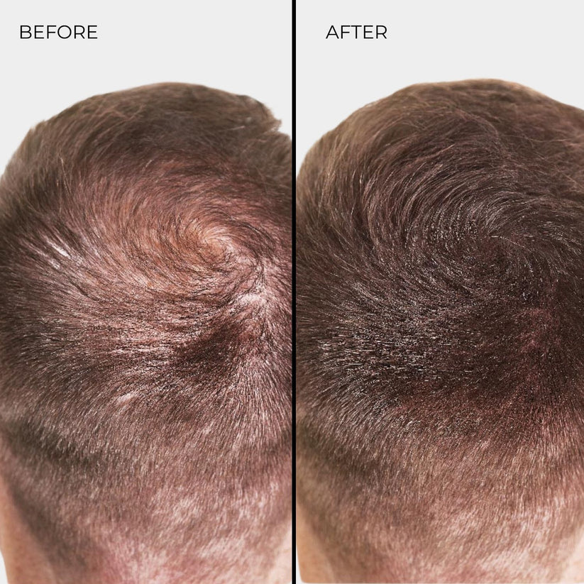 Nanogen Hair Thickening Fibres (Auburn) 15g
