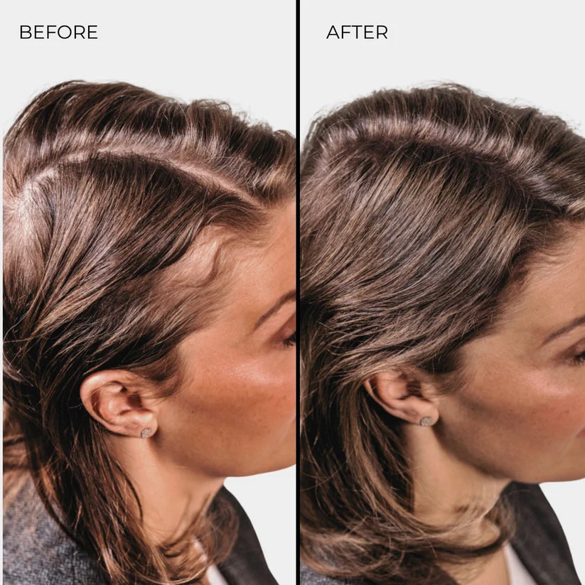Nanogen Hair Thickening Fibres (Light Brown) 15g
