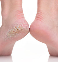 Footlogix Rough Skin Formula