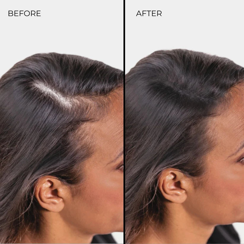 Nanogen Hair Thickening Fibres (Medium Brown) 30g
