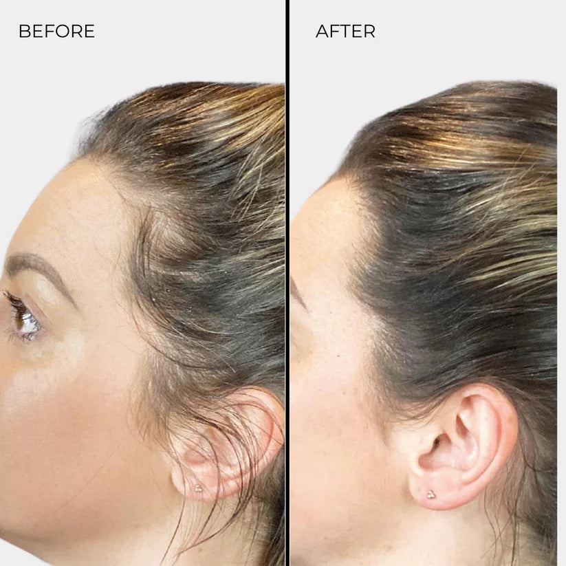 Nanogen Hair Thickening Fibres (Dark Blonde) 15g