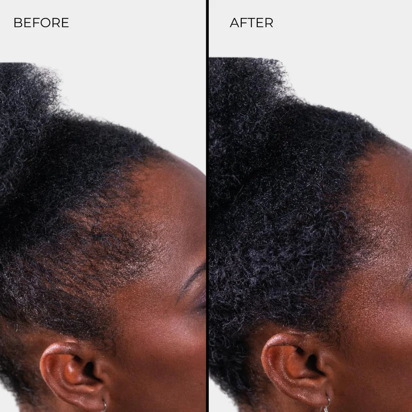 Nanogen Hair Thickening Fibres (Black) 30g