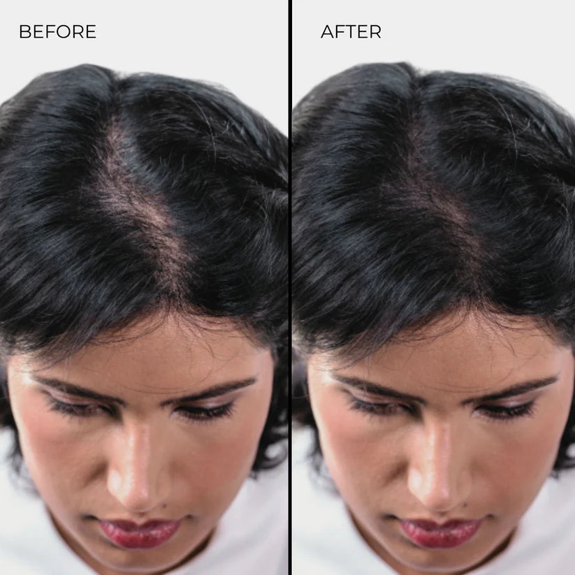 Nanogen Hair Thickening Fibres (Black) 15g